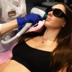 Brazilian laser hair removal