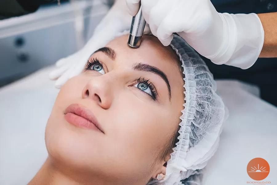 best microdermabrasion treatments in Mississauga, Ontorio, Canada
