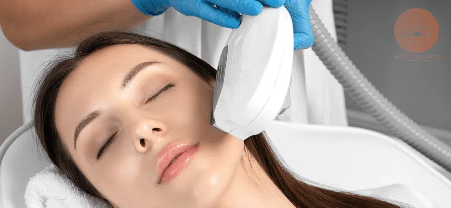 photofacial treatment