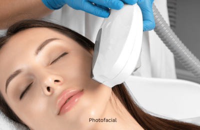 Photofacial (1)